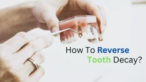 How To Reverse Tooth Decay?